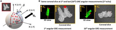 Fiber-orientation independent component of R2* obtained from single-orientation MRI measurements in simulations and a post-mortem human optic chiasm